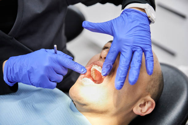 Best Emergency Tooth Extraction in Burgin, KY