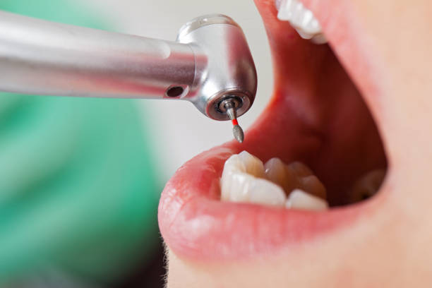 Best Weekend Emergency Dentist in Burgin, KY